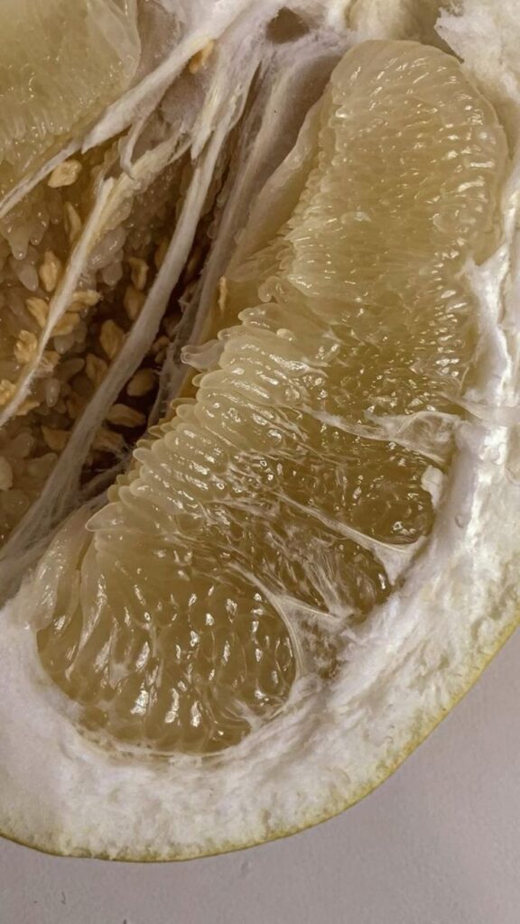 Mental Health Support 